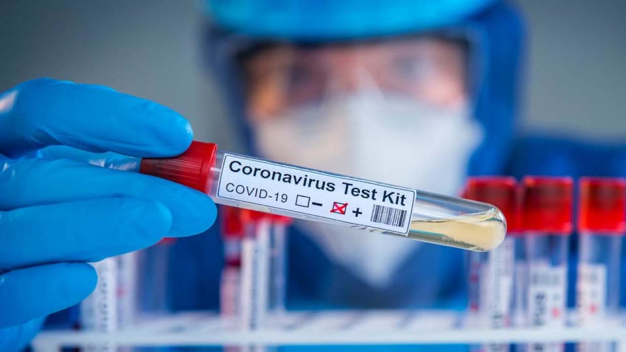 В Молдове зарегистрировали 285 новых случаев COVID-19