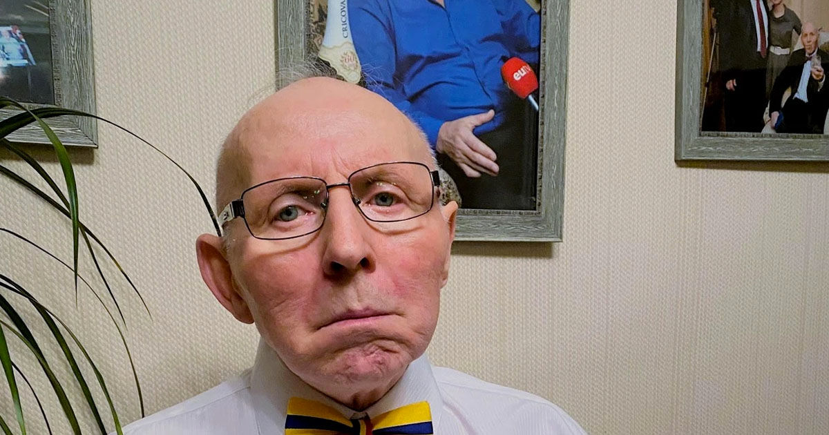 Врачи о состоянии Урски: Он готов к выписке, но из-за семьи это откладывается.