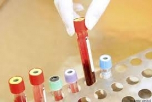 Aceasta este principala cauză a deceselor în R. Moldova, fiind urmată de tumori, din cauza cărora au murit 5 810 moldoveni.