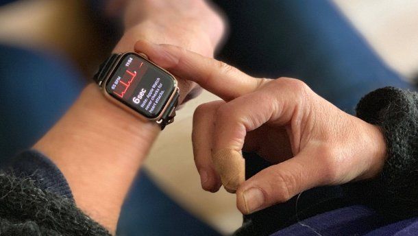 Apple Watch проникла в систему медицинского страхования США.