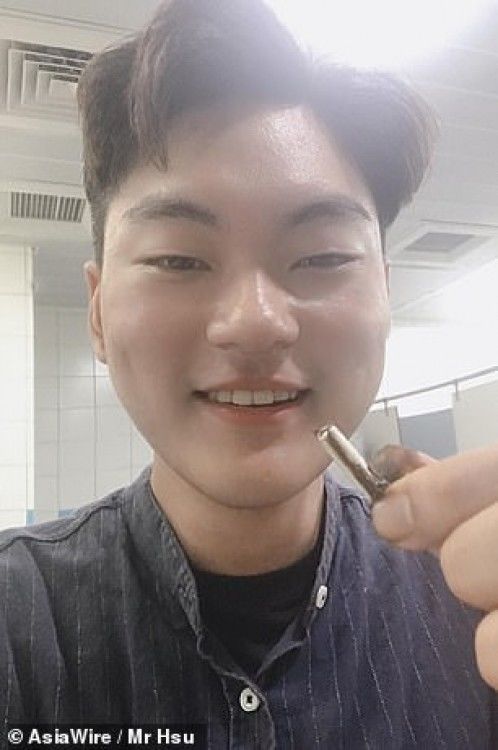 Случайно проглоченный наушник AirPod продолжил работать в желудке