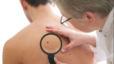 A fost descoperit medicamentul care tratează cancerul de piele. Foto: asds.net