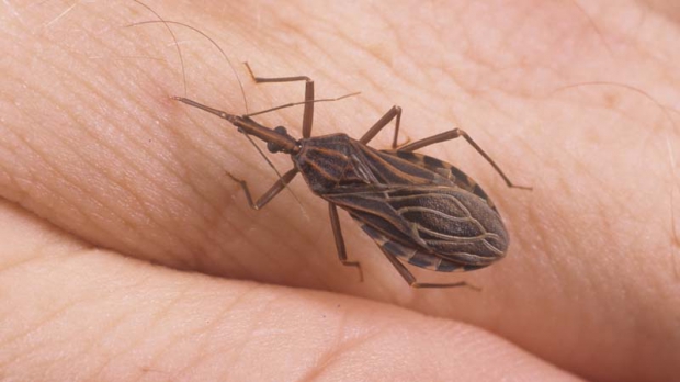 Boala Chagas, provocată de paraziţi transmişi oamenilor înţepătura unor insecte, a fost numită "noua SIDA a Americii"