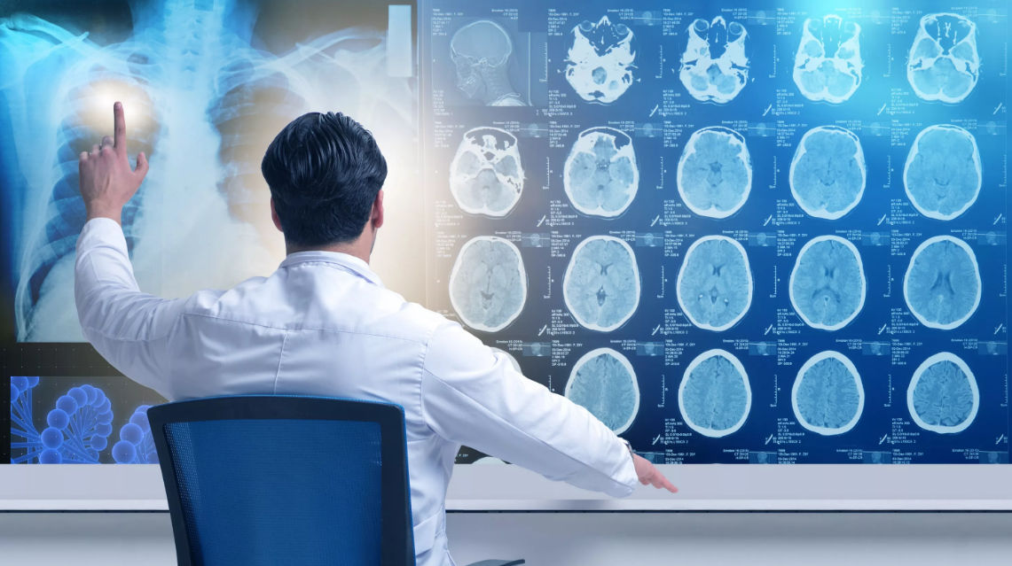 Radiology: ИИ ставит больше ложноположительных диагнозов по сравнению с врачами.