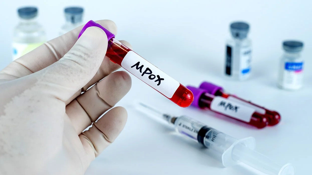 ВОЗ утвердила рекомендации по противодействию вспышке mpox в Африке.