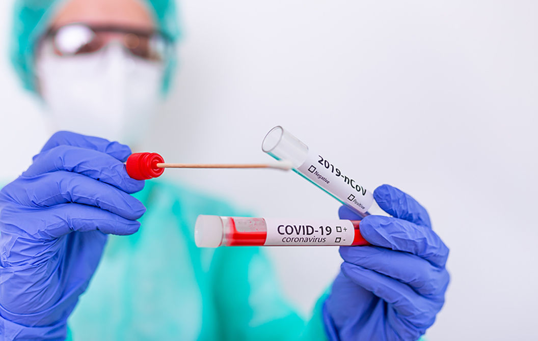 В Молдове зарегистрировали 39 новых случаев COVID-19.