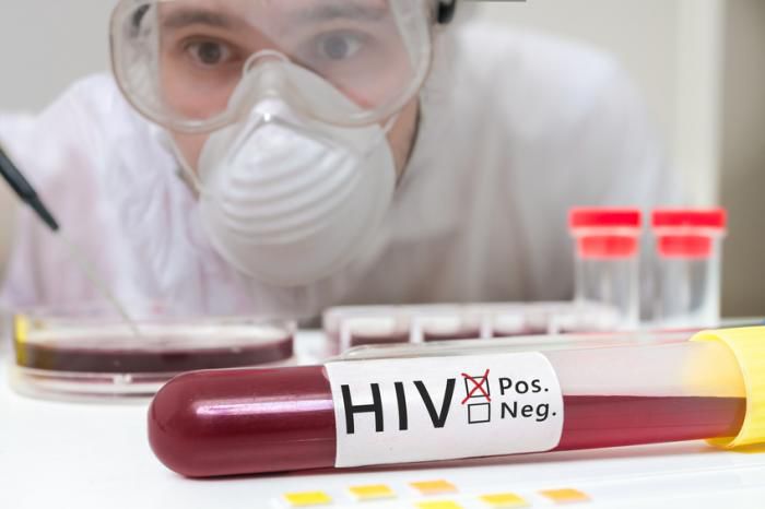 A pretins că e doctor și a infectat zeci de persoane cu HIV. Foto: Medical News Today