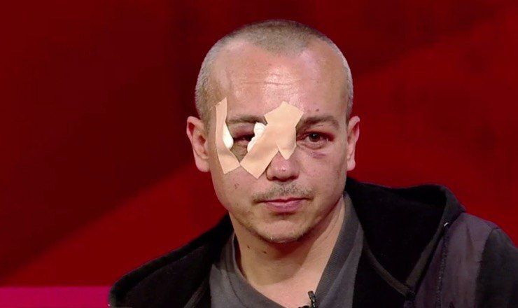 Пассажир троллейбуса рассказал о ДТП на Буюканах.