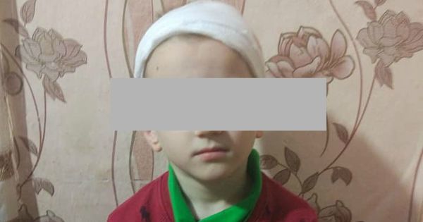 Женщина обвиняет детский сад в том, что у ребенка травма головы.