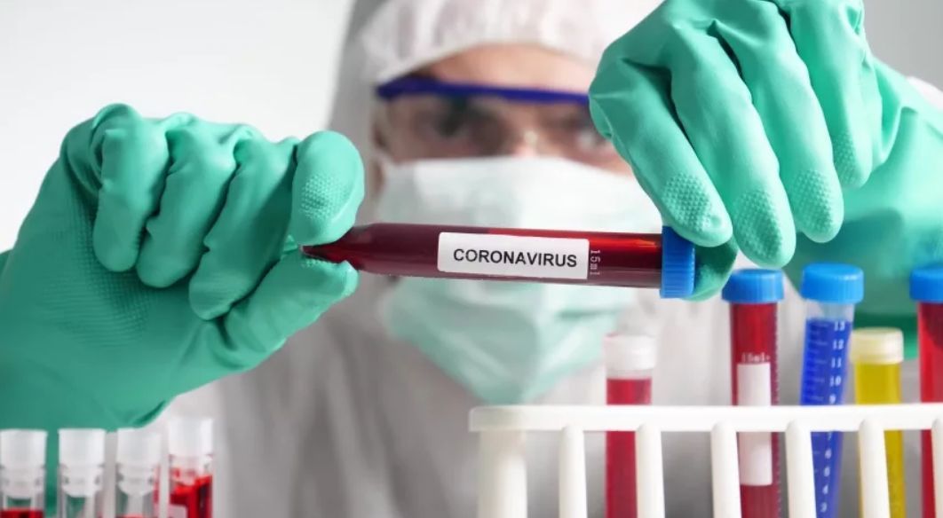 В Молдове зарегистрировали 128 новых случаев COVID-19.
