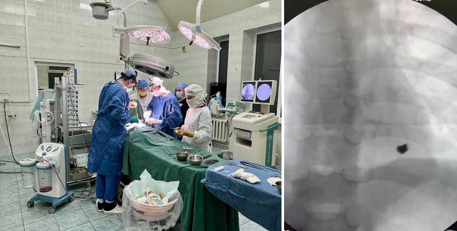 В Одессе ребёнок получил пулевое ранение в сердце: врачам удалось его спасти.