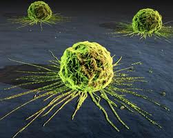 Bacteriile, virusurile şi paraziţii provoacă aproape 2 milioane de cazuri de cancer în fiecare an, spun experţii.