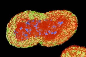 Bacteria HO41 a fost descoperită în Japonia acum doi an, la o femeie în vârstă de 31 de ani.