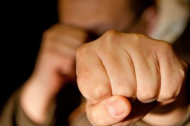 Врачи госпитализировали пострадавшего с черепно-мозговой травмой и сообщили о пациенте в милицию. 