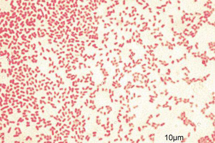 Грамотрицательные бактерии Pseudomonas aeruginosa.   Изображение: Wikimedia Commons