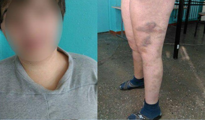 Cazul fetei maltrate în Spitalul de Psihiatrie din Codru, la Procuratură. Foto: unimedia