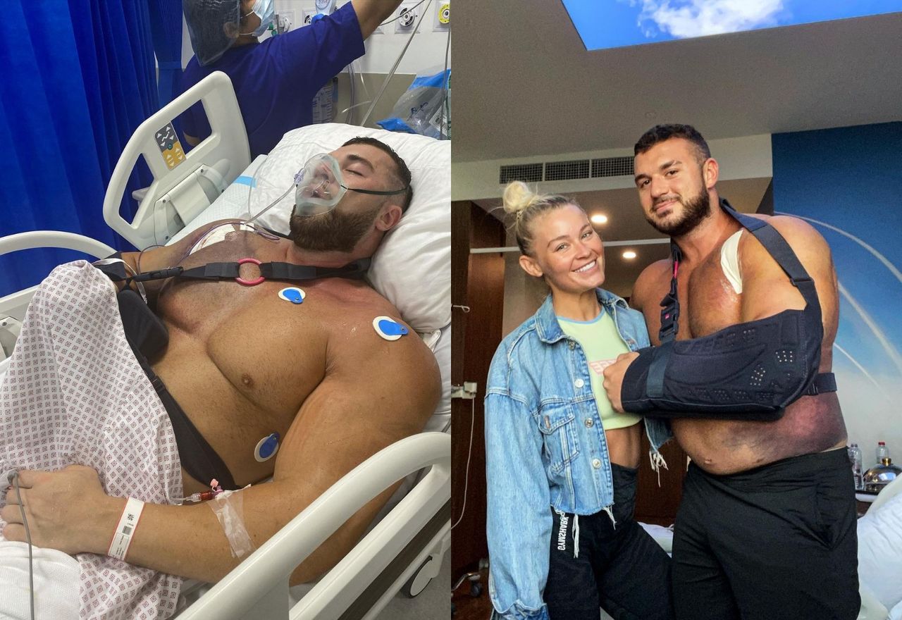 У бодибилдера разорвалась грудная мышца во время жима лежа.