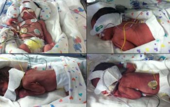 Tressa şi soţul ei, Manuel Montalvo Jr., nu au apelat la tratamente pentru fertilitate. Ei mai au un fiu, Memphis, în vârstă de doi ani.