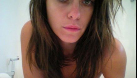 Cazul ei seamănă izbitor cu cel al actriţelor: Scarlett Johansson, Mila Kunis, Jessica Alba, Miley Cyrus, Christina Aguilera şi multe altele.