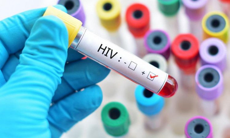 Datele despre pacienții cu HIV din Moldova vor fi integrate într-un sistem informațional.