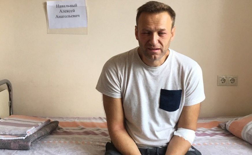 Врач Навального о неправильном выводе из голодовки: Возможна кома.