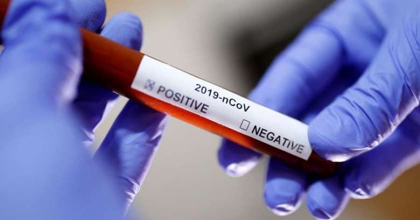 В Приднестровье на фоне роста случаев COVID-19 смертность идет на убыль.