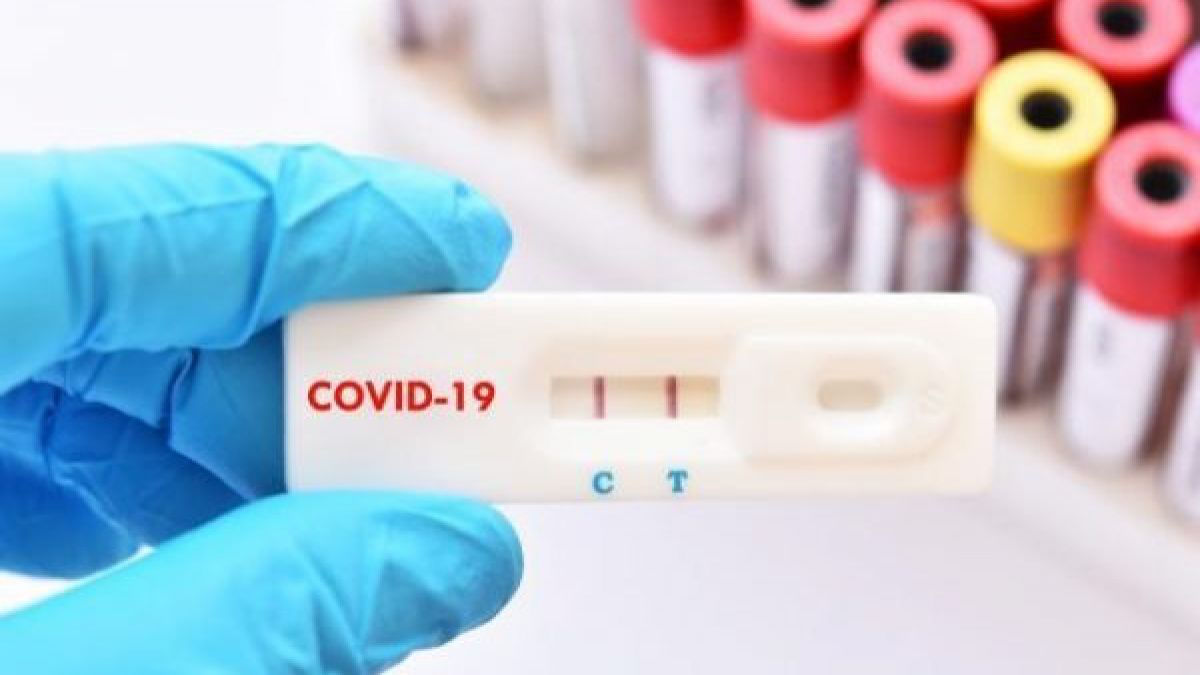 За последнюю неделю зарегистрировано около 350 случаев заражения COVID-19.