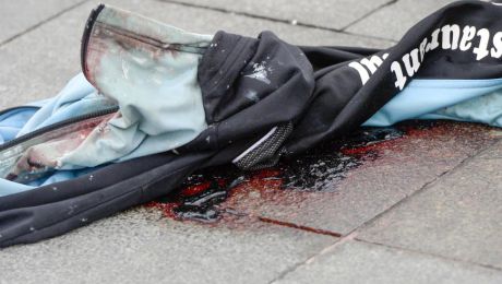 Un bărbat a decedat, fiind strivit de o mașină. Foto simbol: Reuters.com