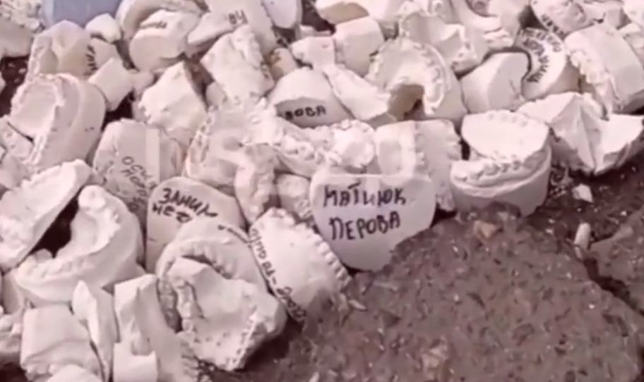 В Запорожье залатали дорогу гипсовыми слепками от челюстей.