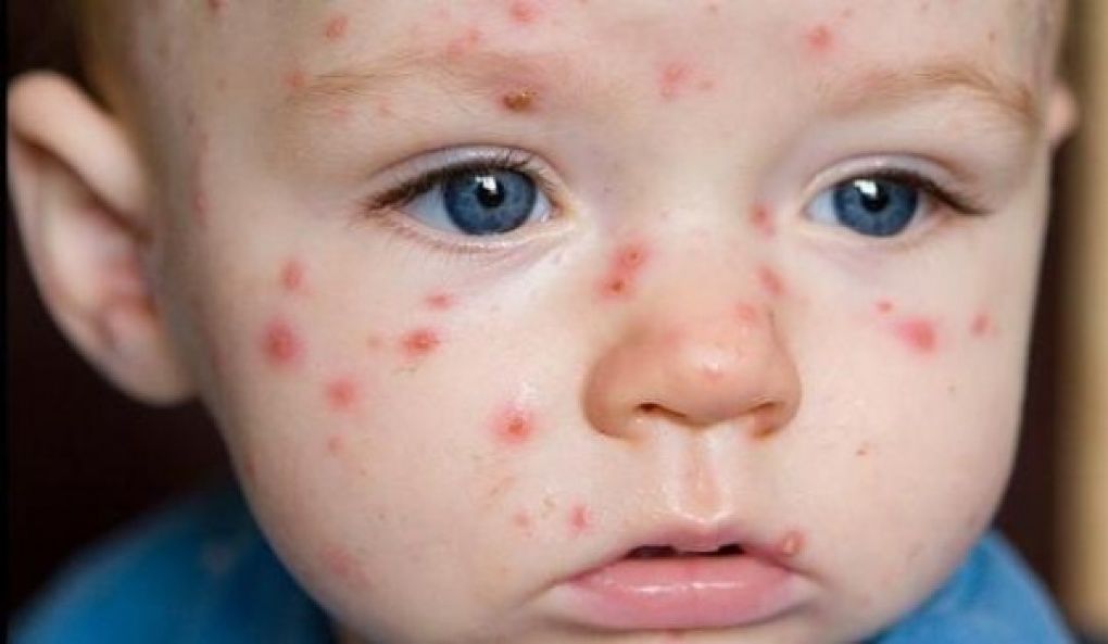 Medicii moldoveni atenționează părinții să-și vaccineze copiii. Foto: suntmamica.ro
