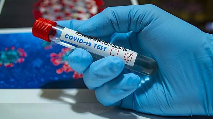 В Молдове зарегистрировали 532 новых случая COVID-19.