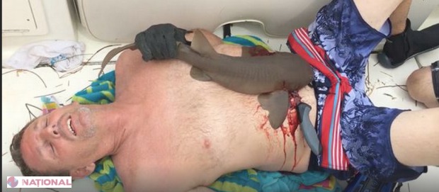 A ieşit din apă cu un rechin înfipt în abdomen!