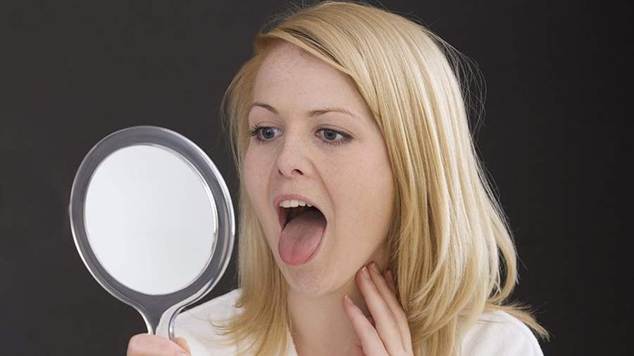 Врач назвал опасные причины белого налета на языке.