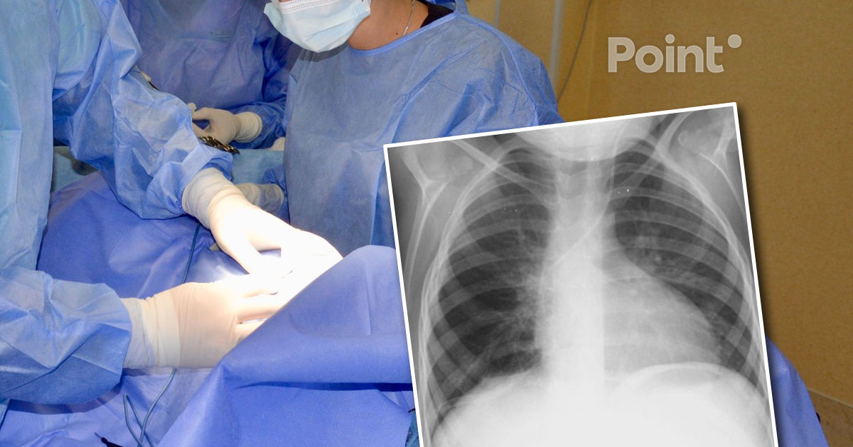 O fetiță, diagnosticată cu o tumoră masivă, a fost operată cu succes de medicii din Chișinău.