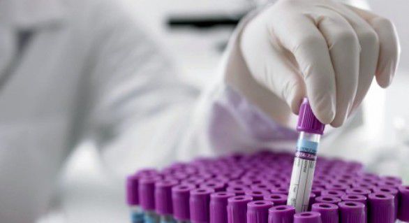 Autoritățile locale din Ucraina au anunţat apariţia unei epidemii de gripă cauzate de virusul A/H1N1.