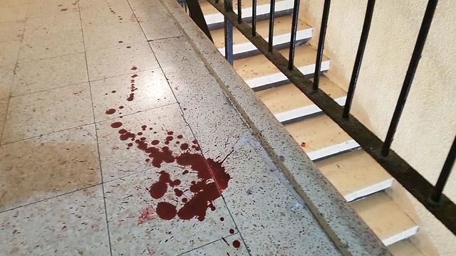 Габриэла с легкими ранениями была доставлена в больницу "Асута".