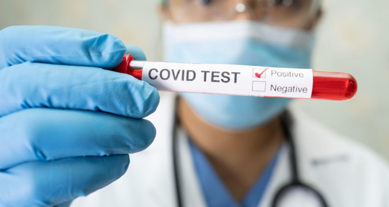 COVID-19 отступает: В больницы Кишинева госпитализированы только два заболевших.