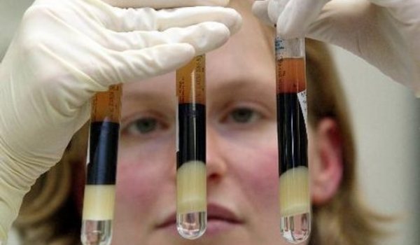 Oamenii de ştiinţă danezi se aşteaptă să obţină în scurt timp rezultate care să arate că „este posibil să identificăm un leac pentru HIV.