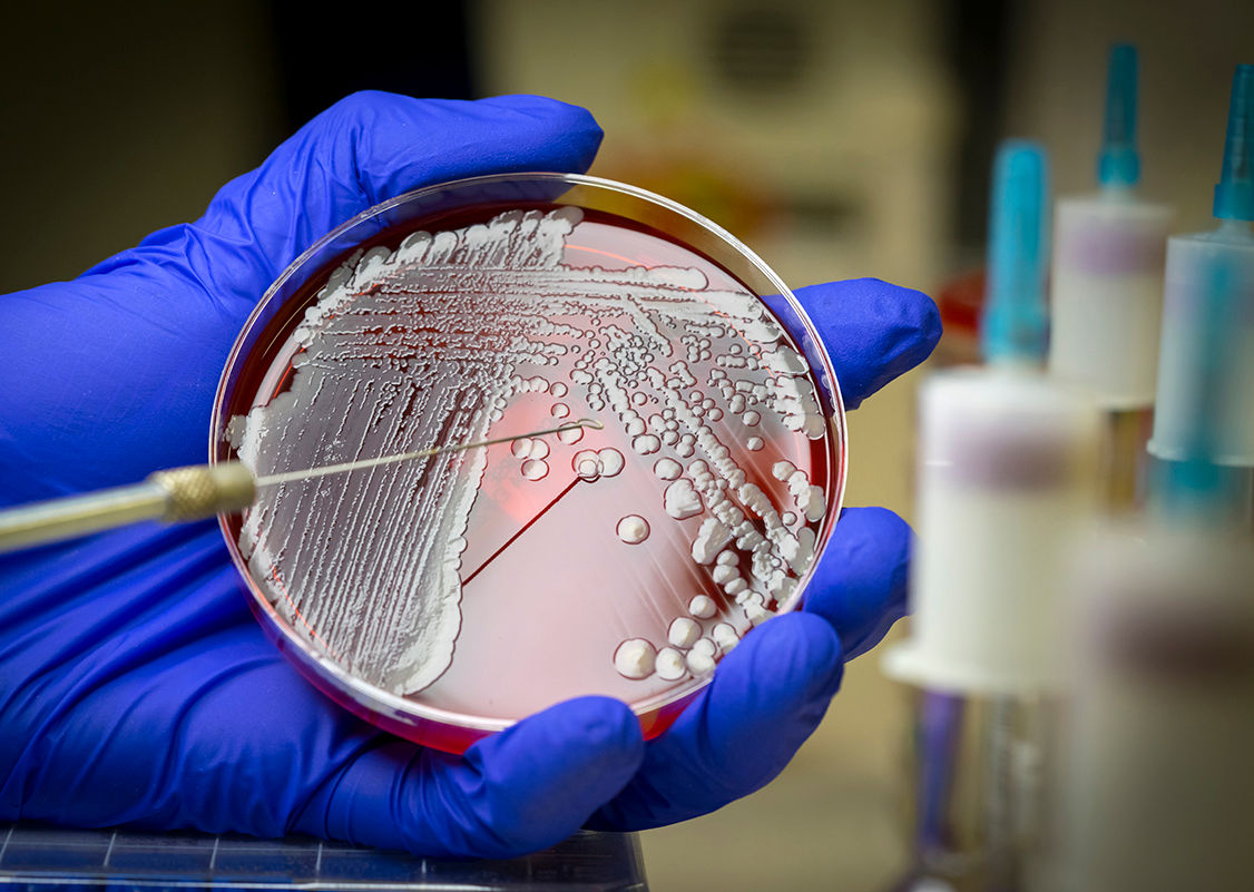 Oameni de știință: Bacteriile orale ucid unele tipuri de cancer.