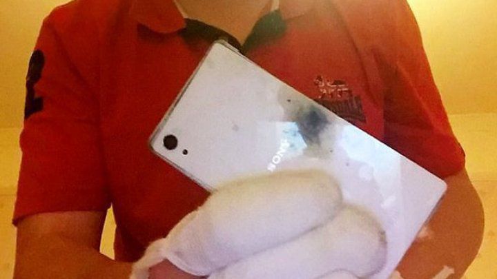 I-a explodat smartphone-ul şi i-a ars toate degetele de la o mână