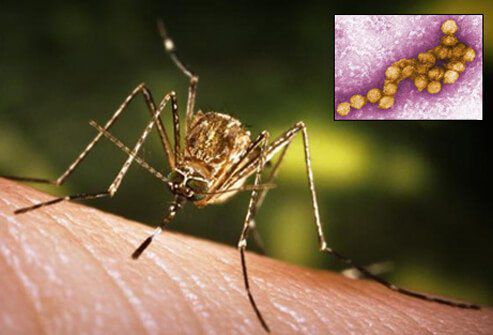 Virus West Nile: Primul caz de encefalită confirmat la hotar cu Moldova