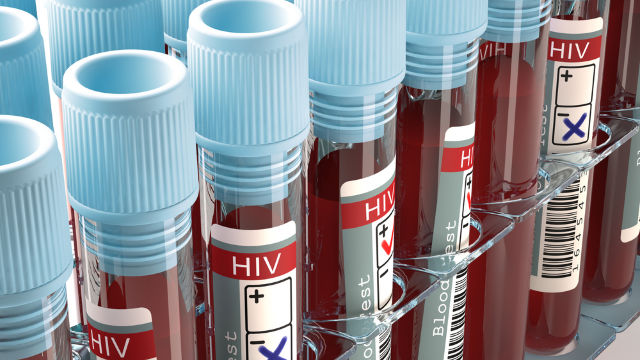 R.Moldova va achiziționa 150 de mii de teste rapide pentru depistarea HIV/SIDA