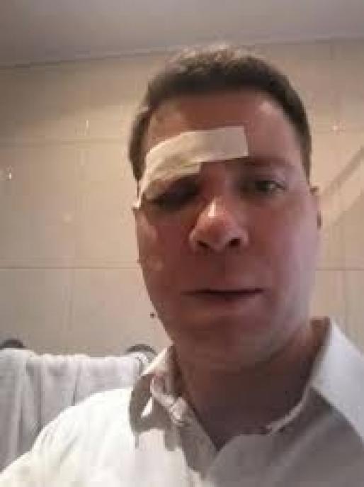 «Это то, что с вами случится, если вы скажете, что поддерживаете Евромайдан".