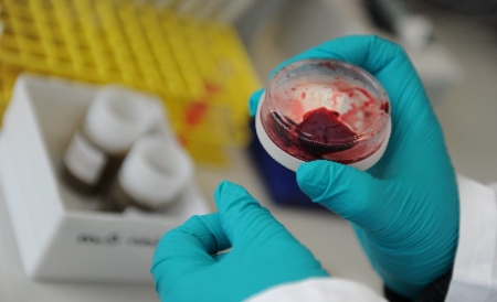 Specialiştii avertizează că noul virus are capacitatea de a distruge foarte repede rinichii pacientului