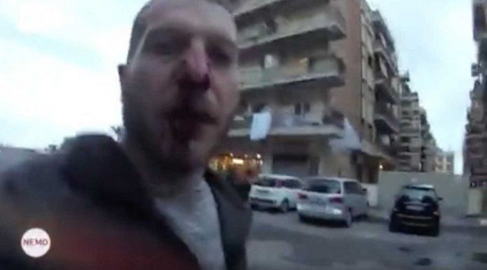Un jurnalist, lovit brutal cu capul în gură de fratele unui renumit mafiot