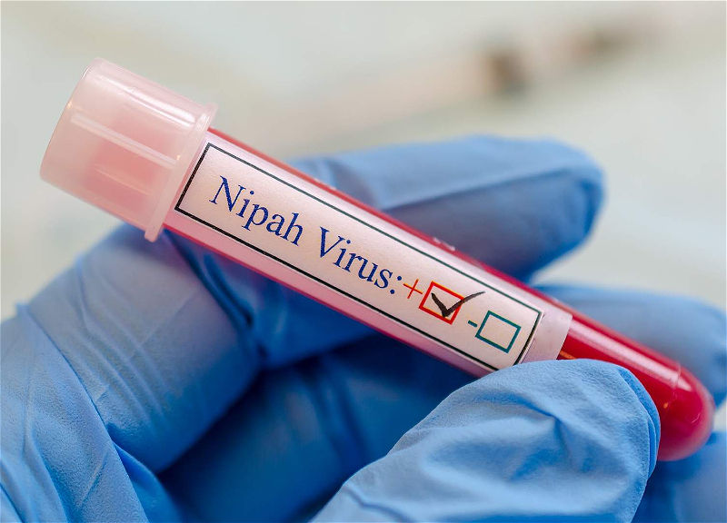 Autoritățile din Moldova nu au teste pentru virusul Nipah.