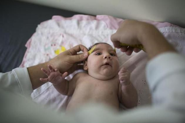 Infecţia cu virusul Zika ar putea afecta femeile însărcinate, ducând la malformaţii.