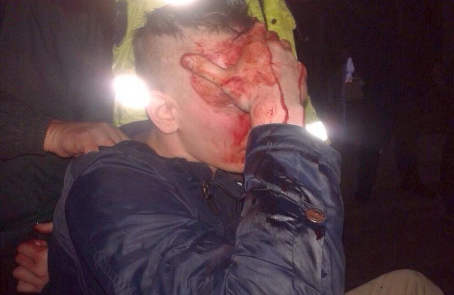 Bătaie până la sânge. Şi-au împărţit pumni şi au spart sticle de cap. Foto simbol: gsp.ro