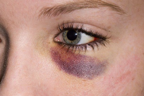Eu sunt Ana: Mama m-a abandonat. Tatăl, fiind iarăși beat, m-a bătut. Foto simbol: nhs.uk