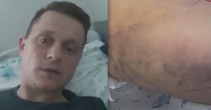 В Кишиневе мужчину с переломом ноги пятый день лечат от коронавируса.